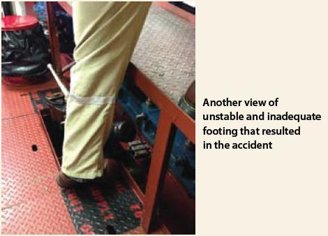 201324 2 ankle injury